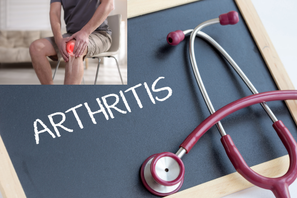 Arthritis Treatment