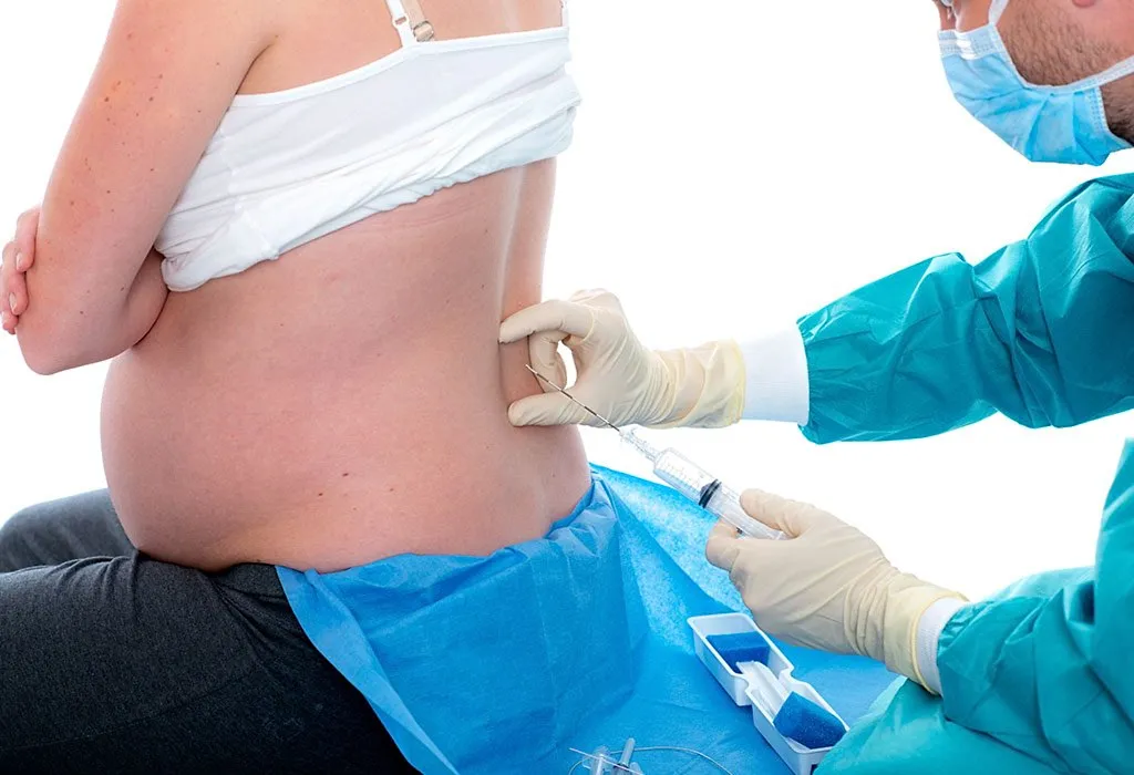 Labor Analgesia (Painless Labour