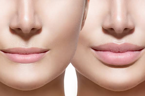 Lip Reshaping