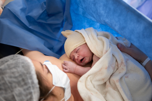 Normal And Cesarean Delivery