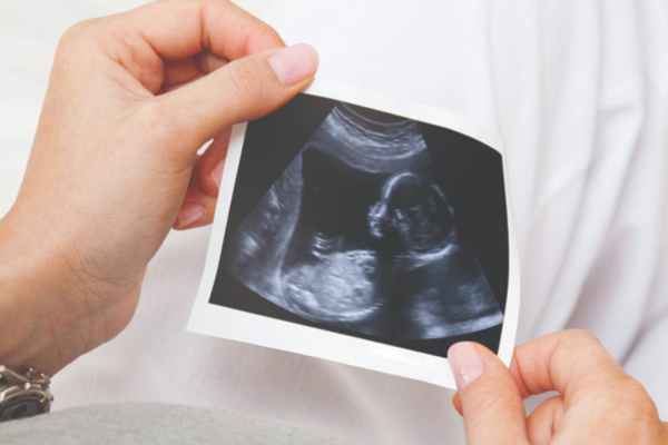 Sonography & Fetal Medicin