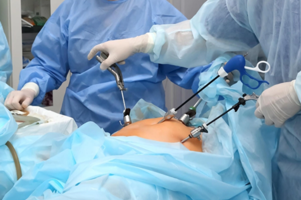 Laparohysteroscopy