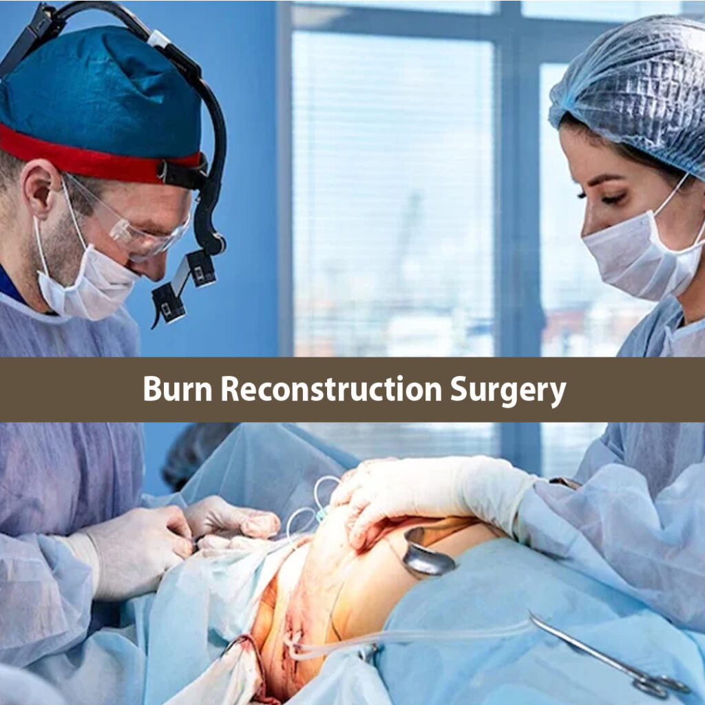 Burn Reconstruction Surgeon In Nagpur