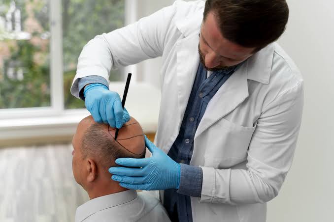 Hair Transplant Doctor In Nagpur