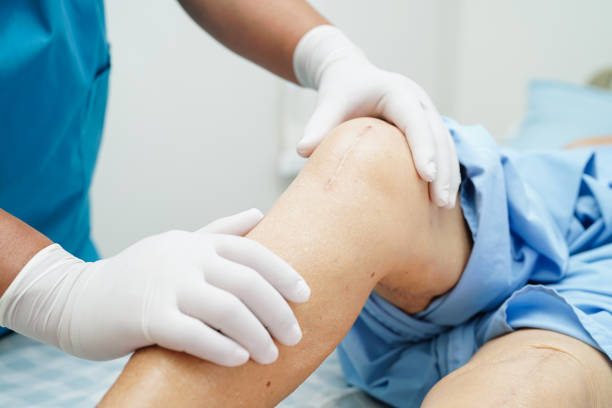 Knee Replacement Doctor In Nagpur