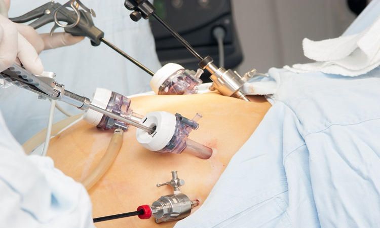 Laparoscopic Gynecologist In Nagpur