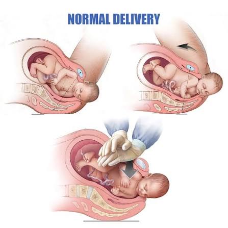 Normal Delivery Doctor In Nagpur