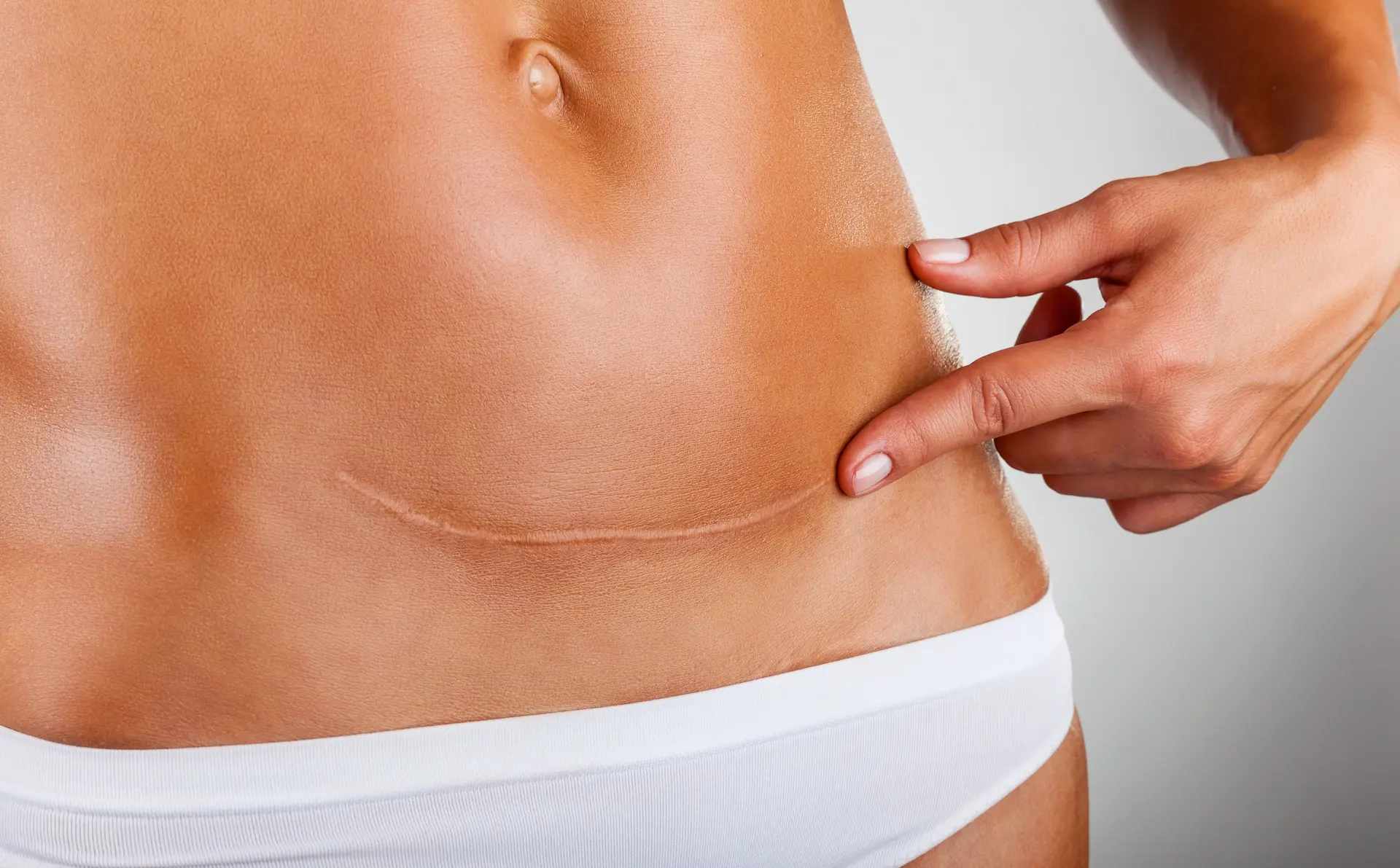 Scar Removal Treatment In Nagpur