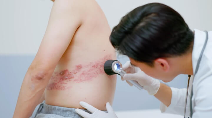 Skin Grafting Specialist In Nagpur